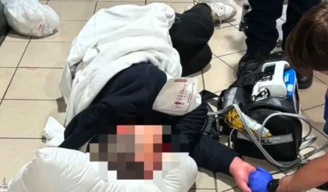 Chinese Student in Melbourne Brutally Beaten by Minors Without Cause; Consulate Warns