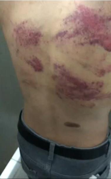 $1M or Die Trying? Youth Held Hostage in Myanmar, Beaten and Begging via Alipay 😡