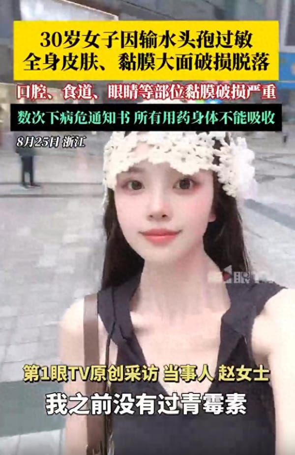 Severe Allergic Reaction to Cephalosporin: A Yunnan Woman's Story