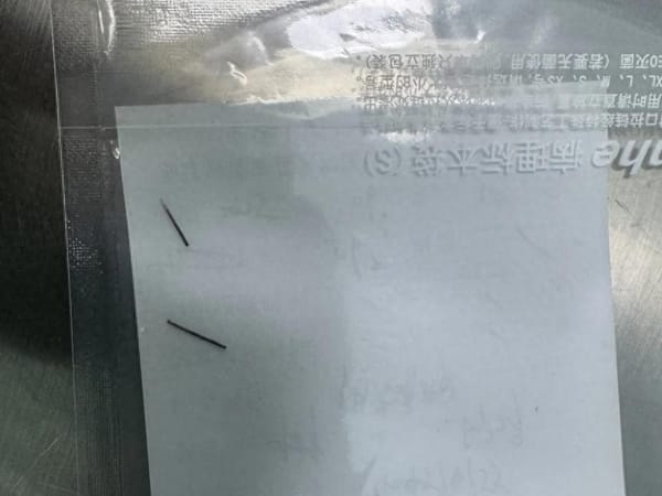 Unbelievable! He Inserted a Sewing Needle into His Urethra…