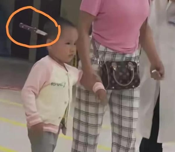 Knife in Head Yet Calm? 3-Year-Old Shocks Onlookers 🤯