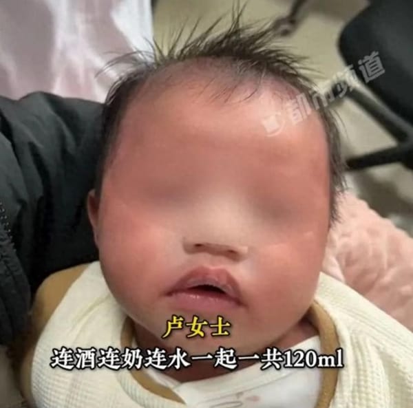 Grandma in Guizhou Mistakenly Mixed Baby Formula with Liquor, 9-Month-Old Nearly Poisoned