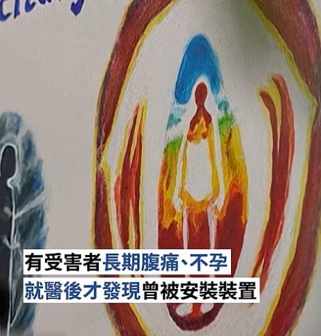 Forced Birth Control Scandal in Greenland